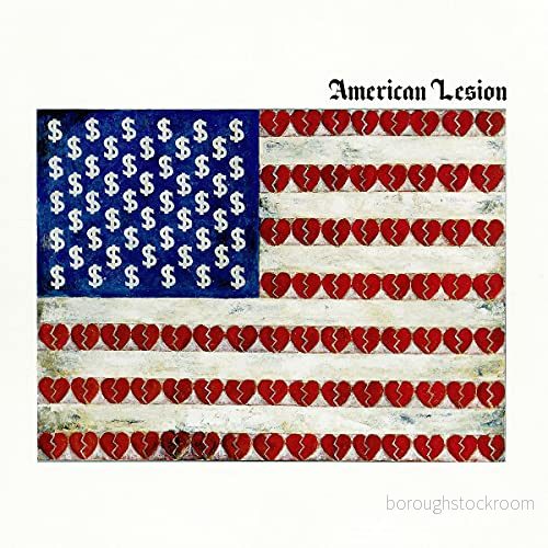 American Lesion 8714092776515
